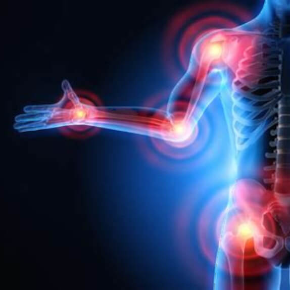 Soulager les inflammations avec le CBD : Une alternative naturelle pour apaiser les douleurs chroniques